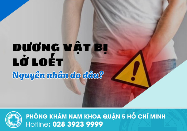 Dương vật bị lở loét là do đâu?