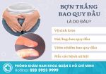 Giải mã nguyên nhân bợn trắng bao quy đầu và cách xử lý hiệu quả