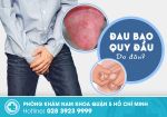 Nam giới bị đau bao quy đầu do đâu? Top những nguyên nhân dễ bị bỏ sót