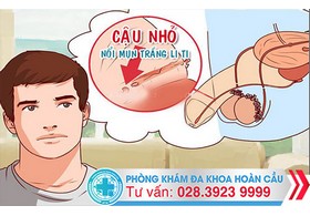 Bệnh mụn dương vật