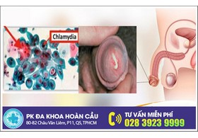 Bệnh nấm Chlamydia ở nam giới