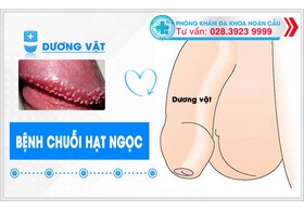 Tổng quan bệnh hạt ngọc dương vật