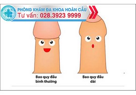 Triệu chứng dài bao quy đầu
