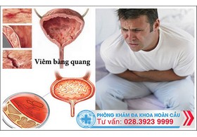 Xuất huyết bàng quang có phải là dấu hiệu viêm bàng quang?