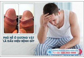 Dấu hiệu phù nề ở dương vật thận trọng với các bệnh lý nguy hiểm?