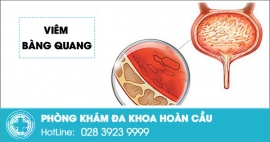 Triệu chứng viêm bàng quang – đọc ngay tại đây!