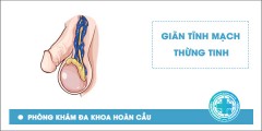 Tổng hợp những lý do gây đau nhức tinh hoàn có thể bạn chưa biết