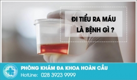 Đi tiểu ra máu dấu hiệu nguy hiểm bệnh nam giới