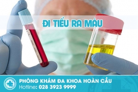Đi tiểu ra máu ở nam giới cần cảnh giác với bệnh lý nam khoa nguy hiểm