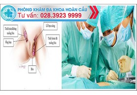 Tinh hoàn lạc chỗ - Mối nguy hiểm và cách điều trị hiệu quả