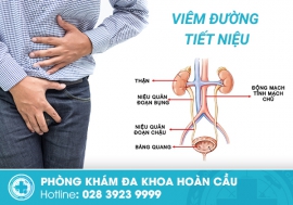 Chữa viêm đường tiết niệu bằng phương pháp mới