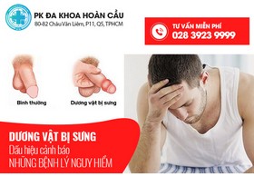Dương vật bị sưng - dấu hiệu cảnh báo những bệnh lý nguy hiểm