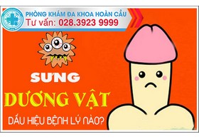 Dương vật bị sưng là dấu hiệu bệnh gì?