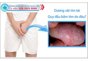 Dương vật tím tái, quy đầu bầm tím do đâu?