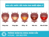 Màu sắc nước tiểu phản ánh tình trạng sức khỏe nam giới