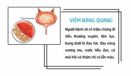 Phát hiện máu trong nước tiểu nam giới cần chú ý cảnh giác