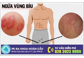Ngứa bìu tinh hoàn là triệu chứng bệnh gì?