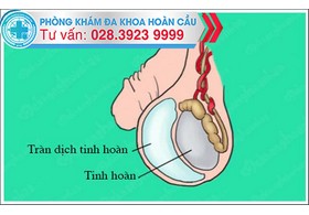Nguyên nhân gây tràn dịch màng tinh hoàn
