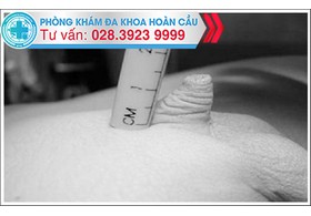 Nguyên nhân khiến dương vật nhỏ xíu
