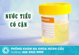 Nước tiểu có cặn nam giới nên cảnh giác điều gì?
