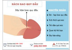 Rách bao quy đầu là bị gì nguyên nhân và cách điều trị