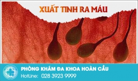 Hiện tượng tinh trùng máu ở nam giới
