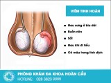Tổng quan về bệnh viêm tinh hoàn ở nam giới