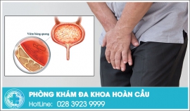Viêm bàng quang ở nam giới có nguy hiểm không?