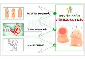 Dấu hiệu viêm bao quy đầu ở nam giới
