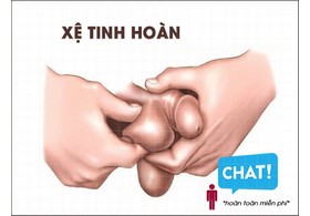 Xệ tinh hoàn - nguyên nhân do đâu?
