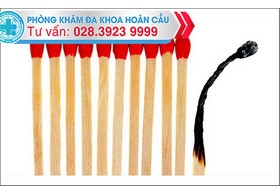 Chữa xuất tinh sớm ở đâu là hiệu quả